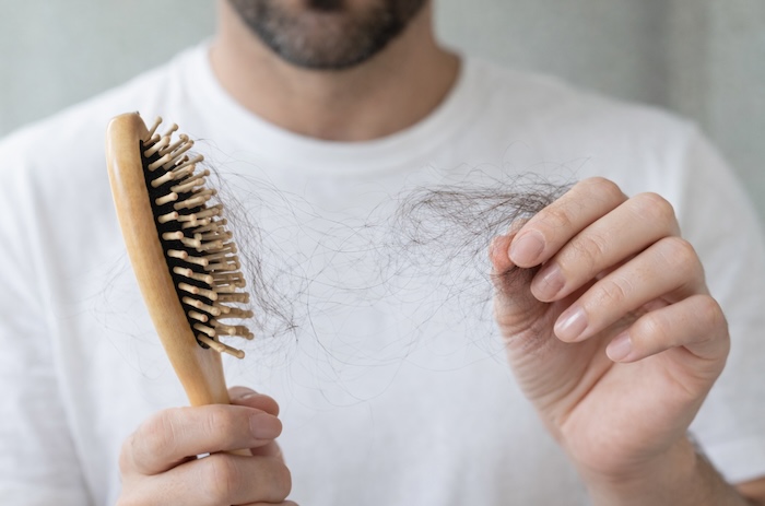 Varför tappar man hår? Orsaker, symptom och tips vid håravfall