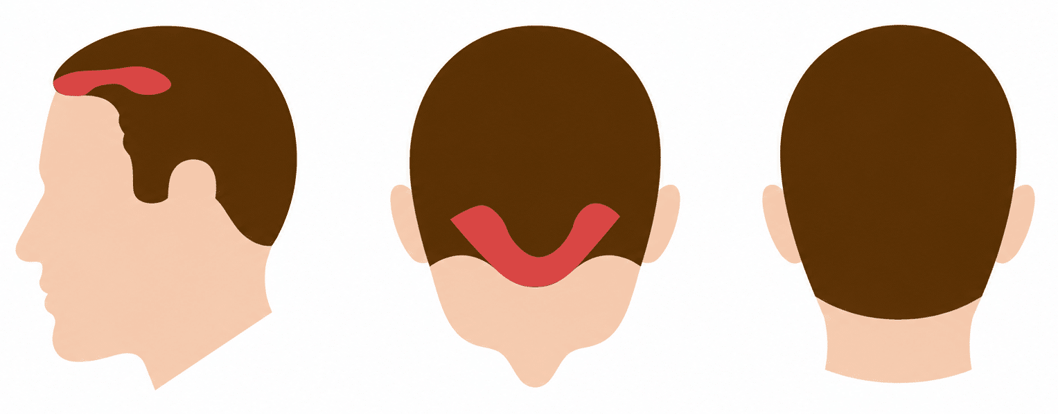 Hair Layer