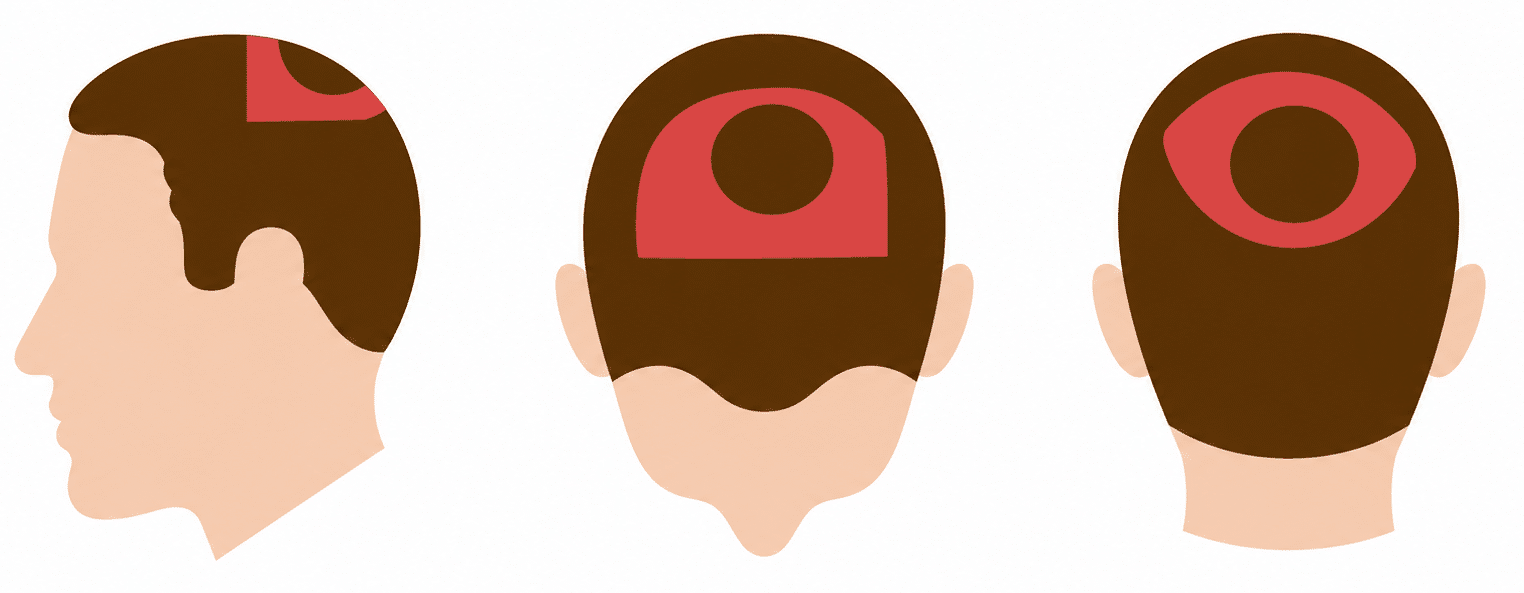 Hair Layer