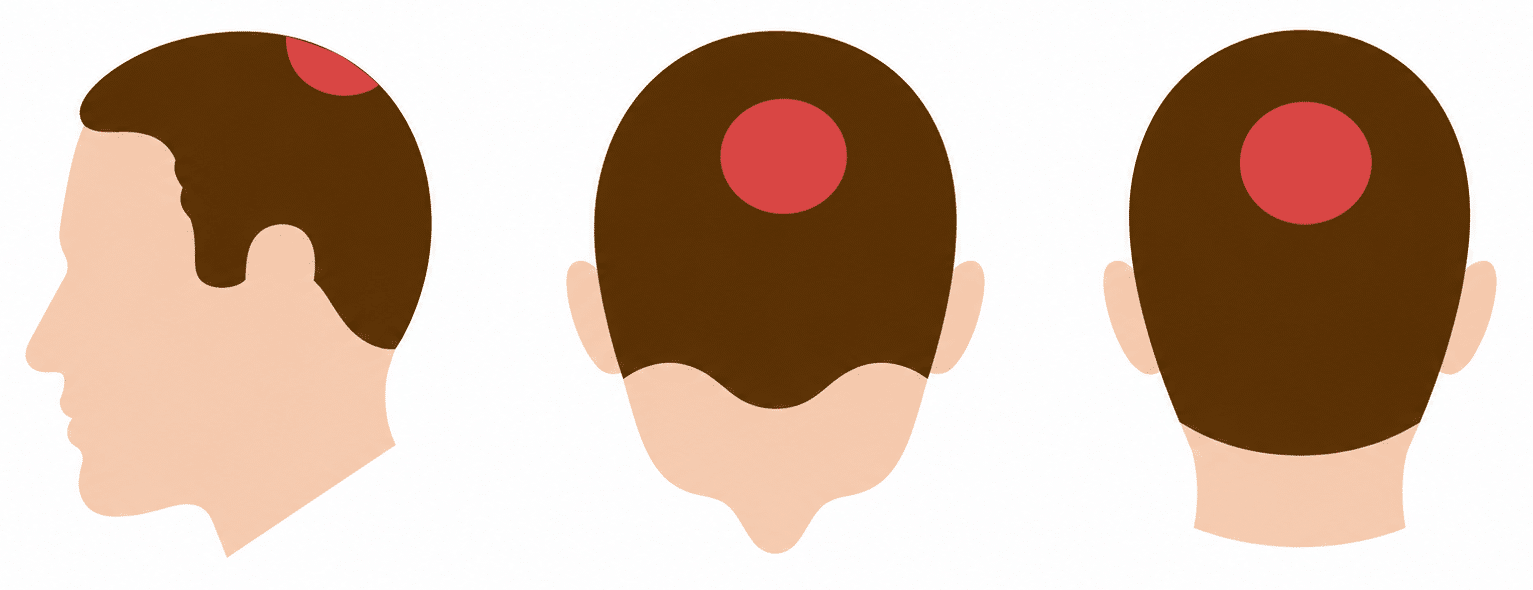Hair Layer