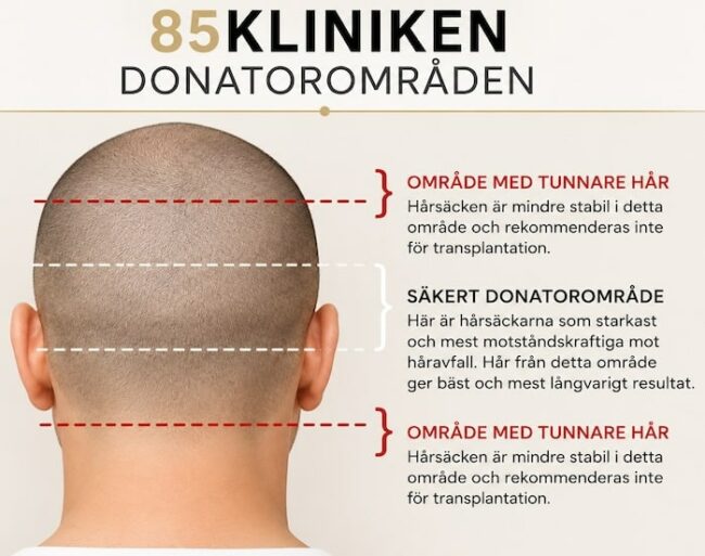 hartransplantation-donatoromradet