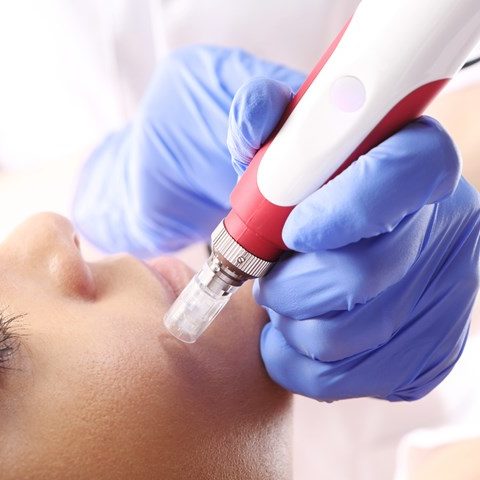 85 kliniken microneedling