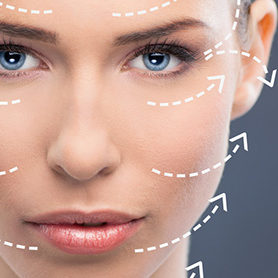 85 kliniken trådlyft